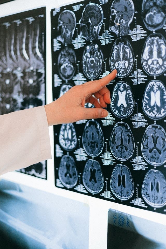 8 Maneiras simples de melhorar o seu poder cerebral
